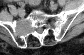 radiof-1
